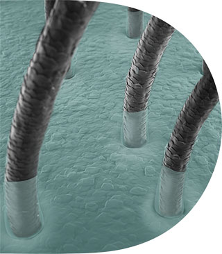 compoziția sebumului Dezechilibrul