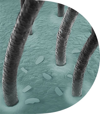 bariera scalpului Dezechilibru